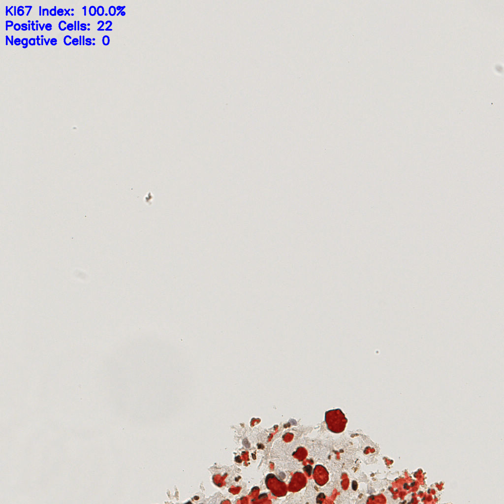 slice_22_19_x19712_y17024.png