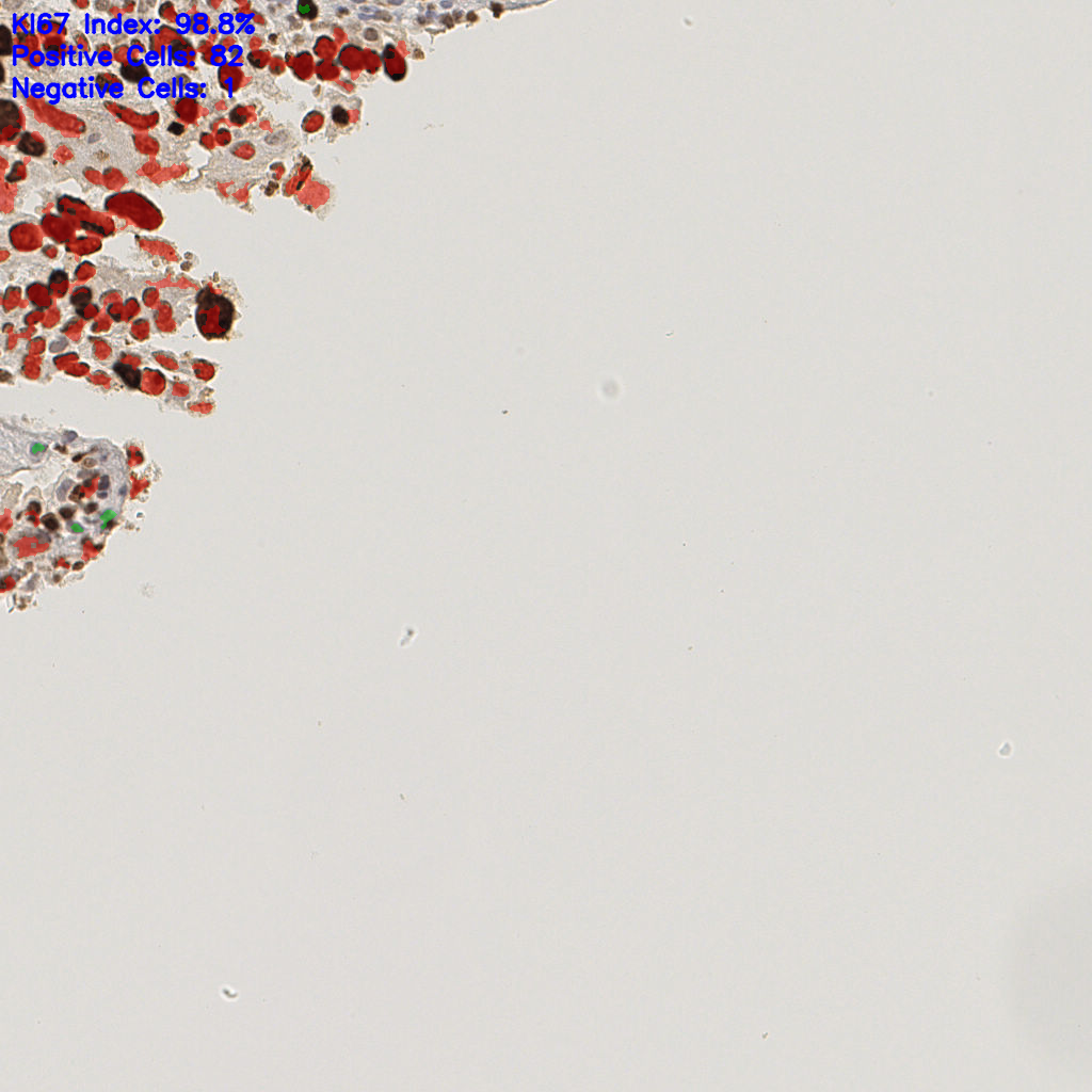 slice_23_21_x20608_y18816.png