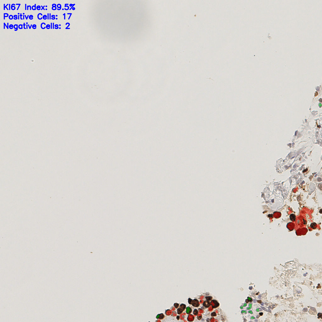 slice_37_7_x33152_y6272.png
