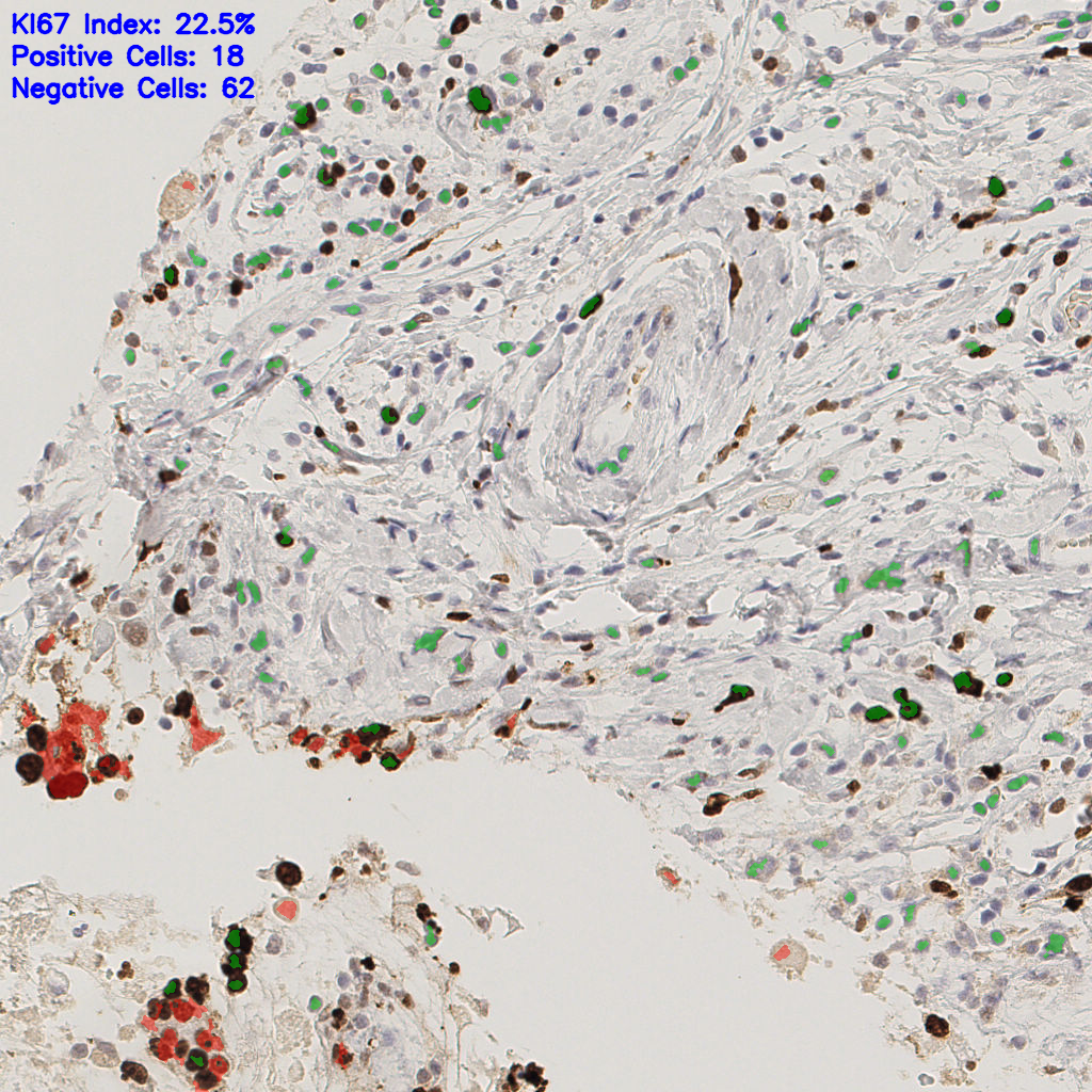 slice_38_7_x34048_y6272.png