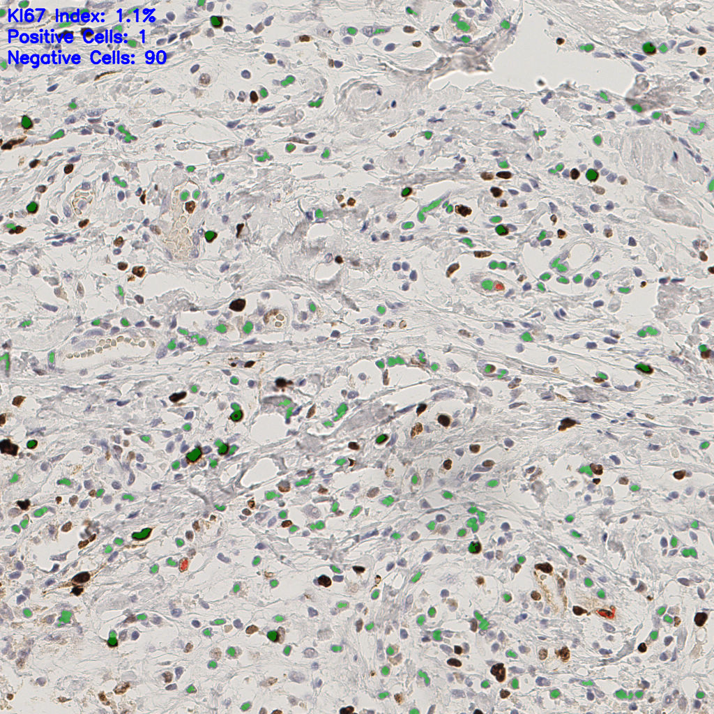 slice_39_7_x34944_y6272.png