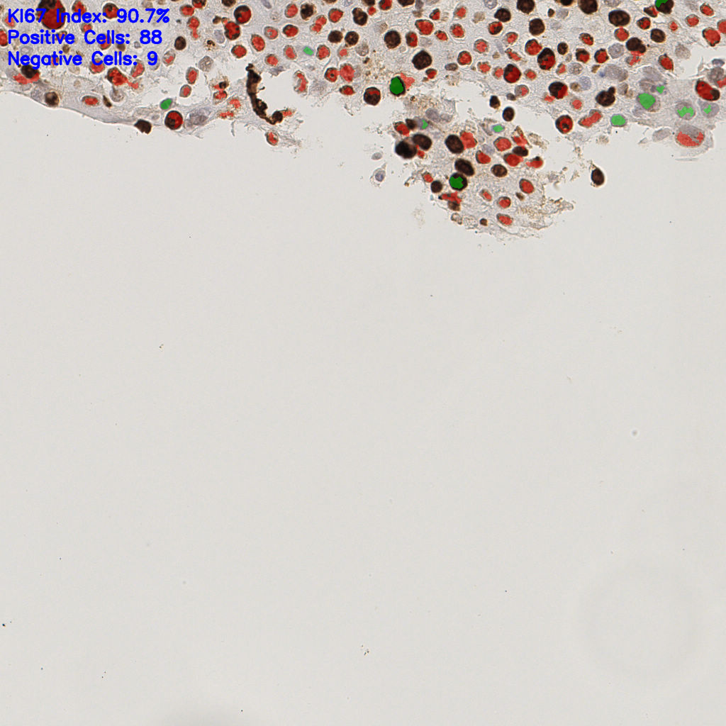 slice_39_9_x34944_y8064.png