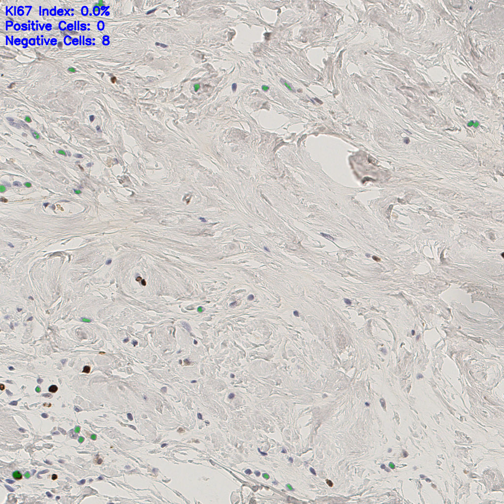 slice_40_6_x35840_y5376.png