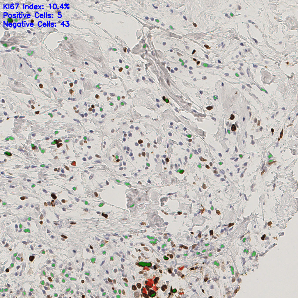 slice_40_7_x35840_y6272.png