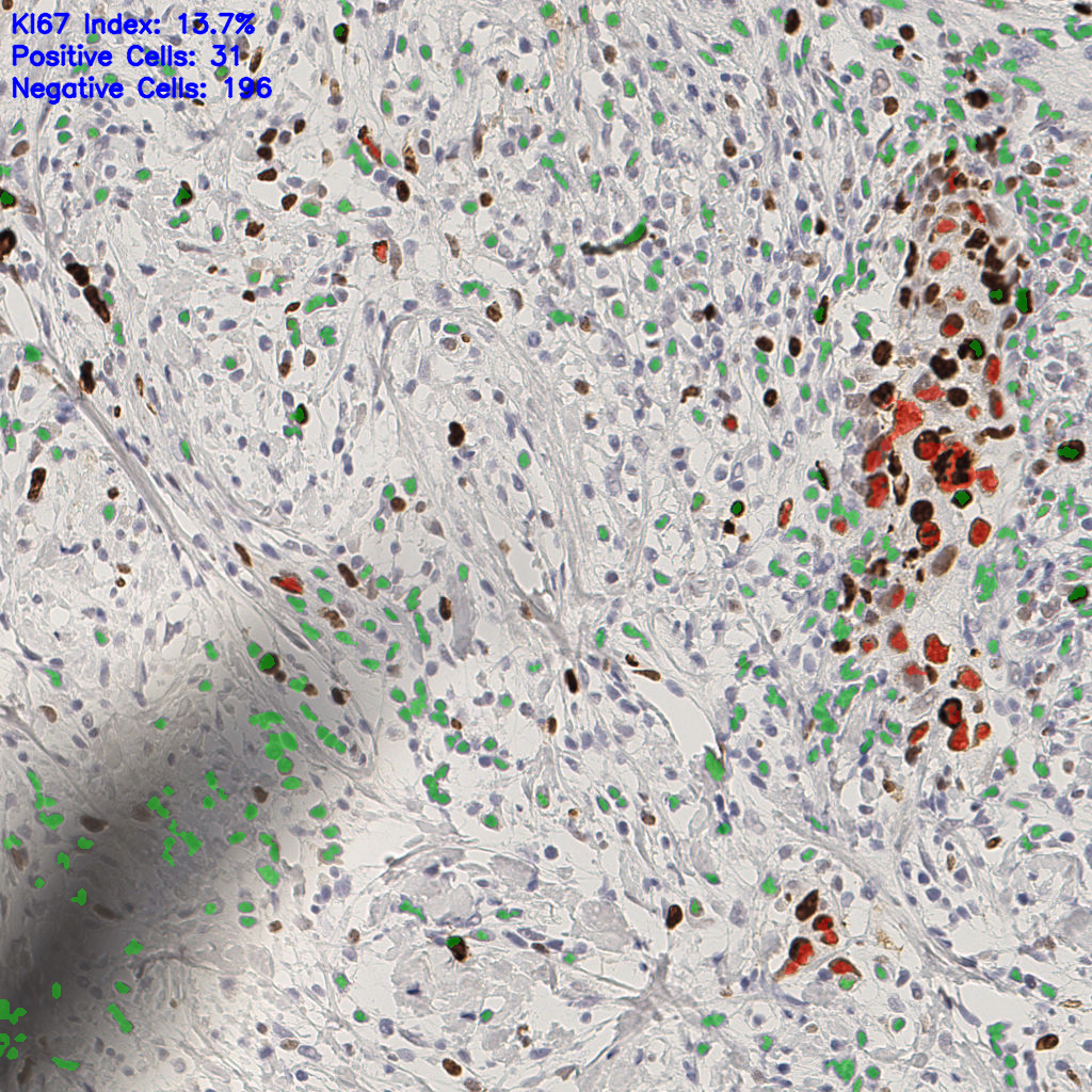 slice_41_17_x36736_y15232.png