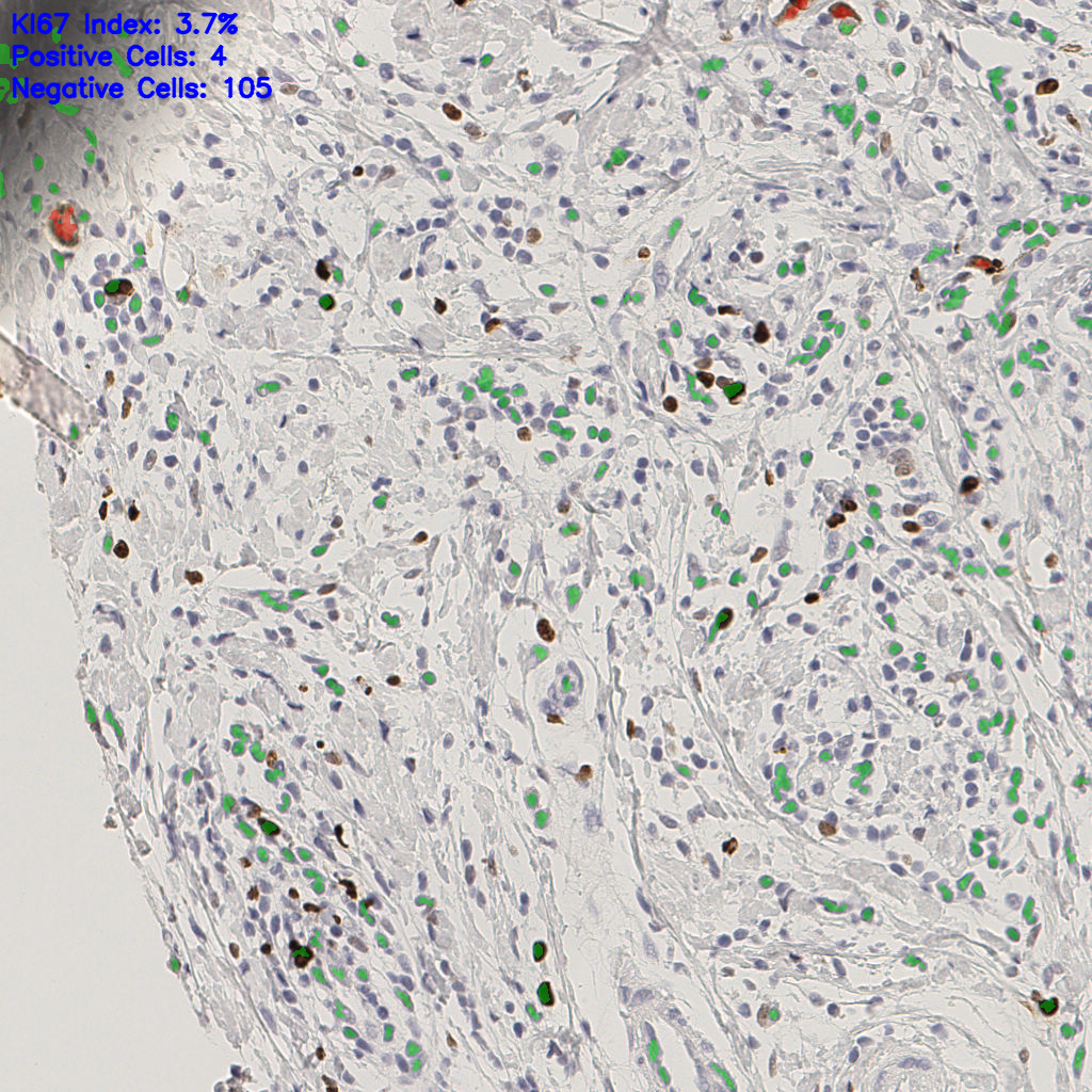 slice_41_18_x36736_y16128.png