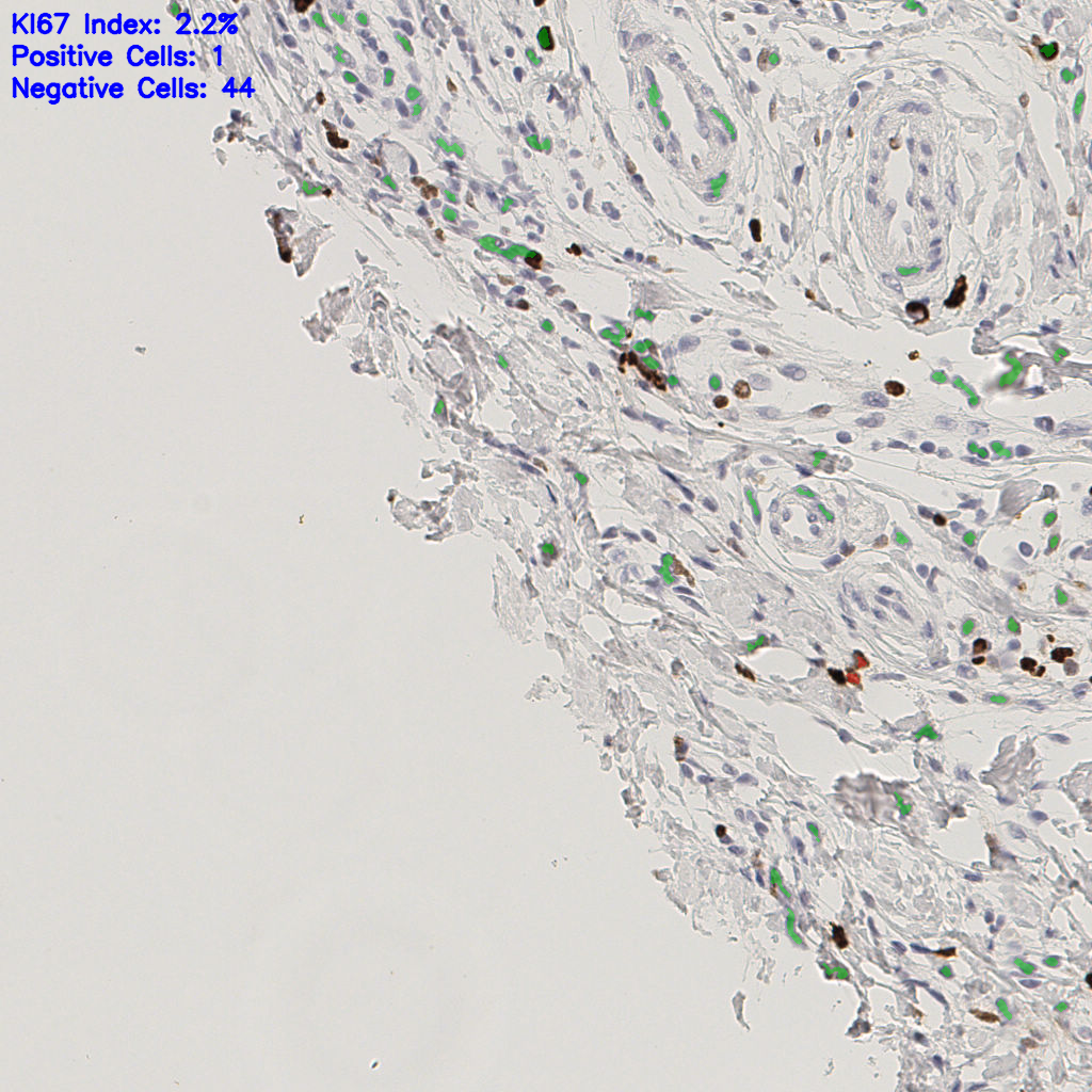 slice_41_19_x36736_y17024.png