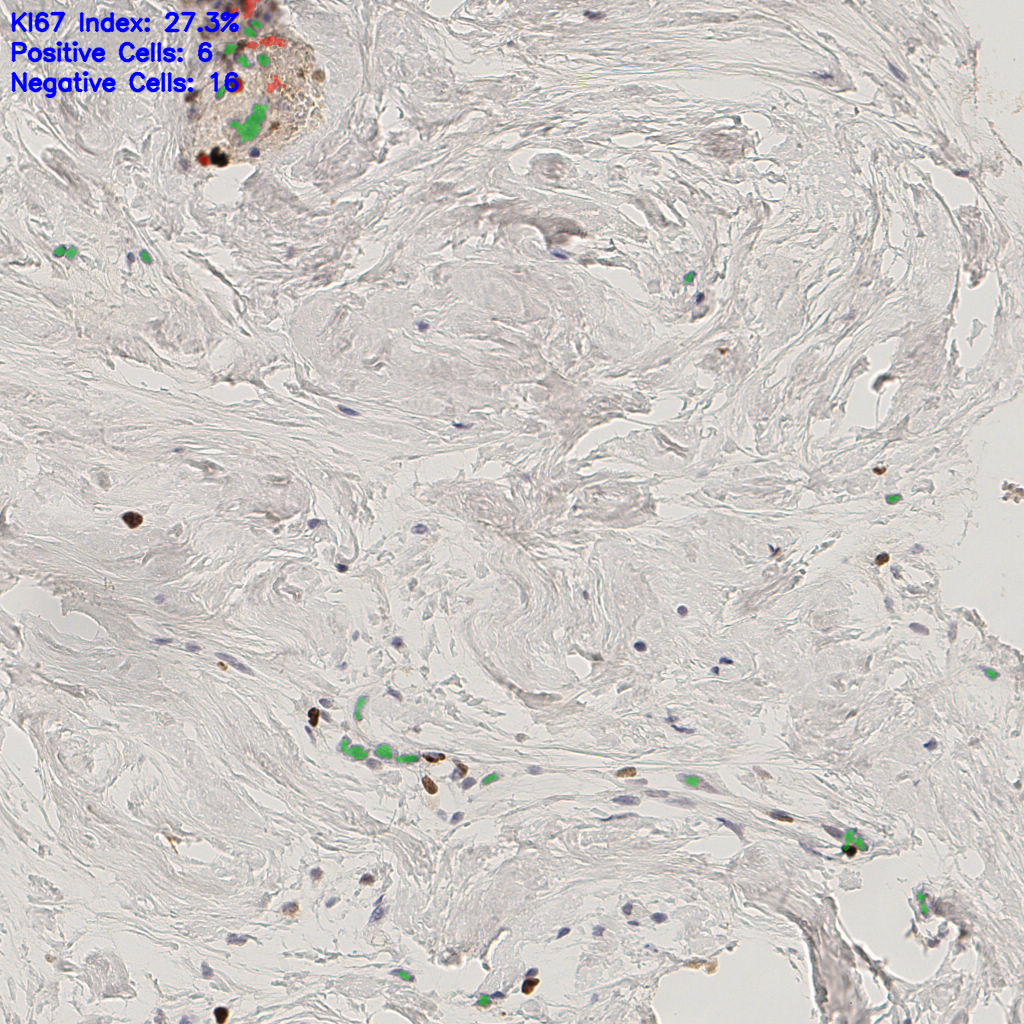 slice_41_6_x36736_y5376.png