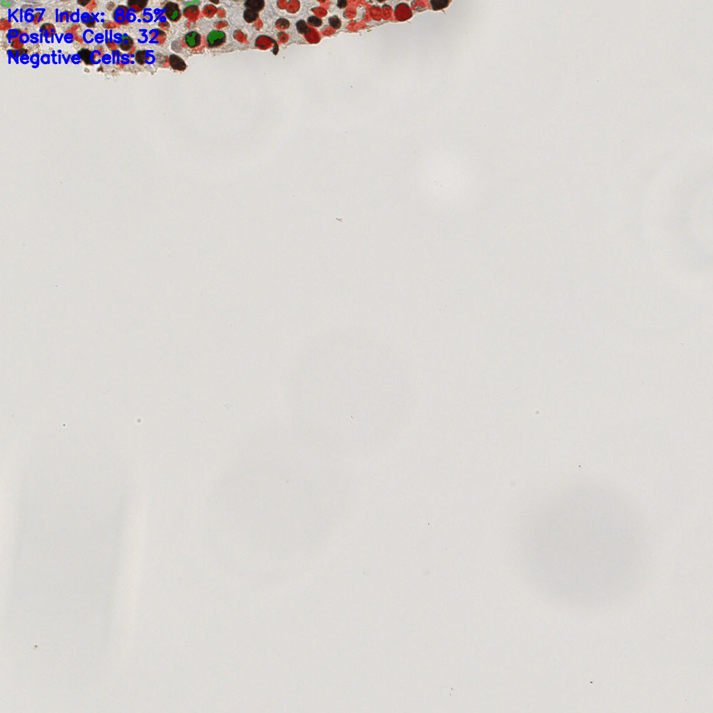 slice_42_10_x37632_y8960.png