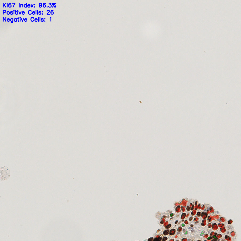 slice_42_13_x37632_y11648.png