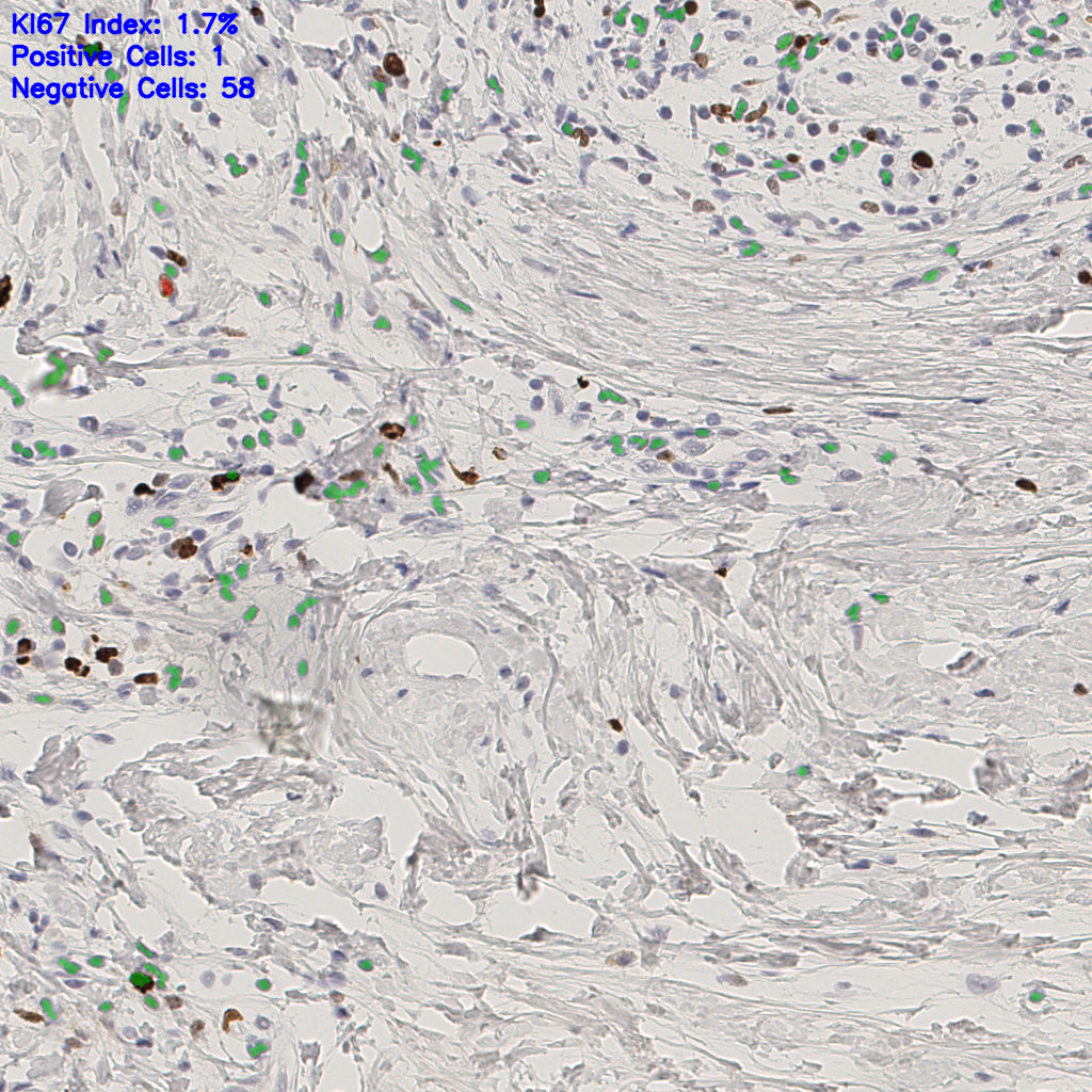 slice_42_19_x37632_y17024.png