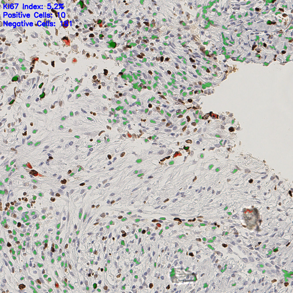 slice_43_16_x38528_y14336.png