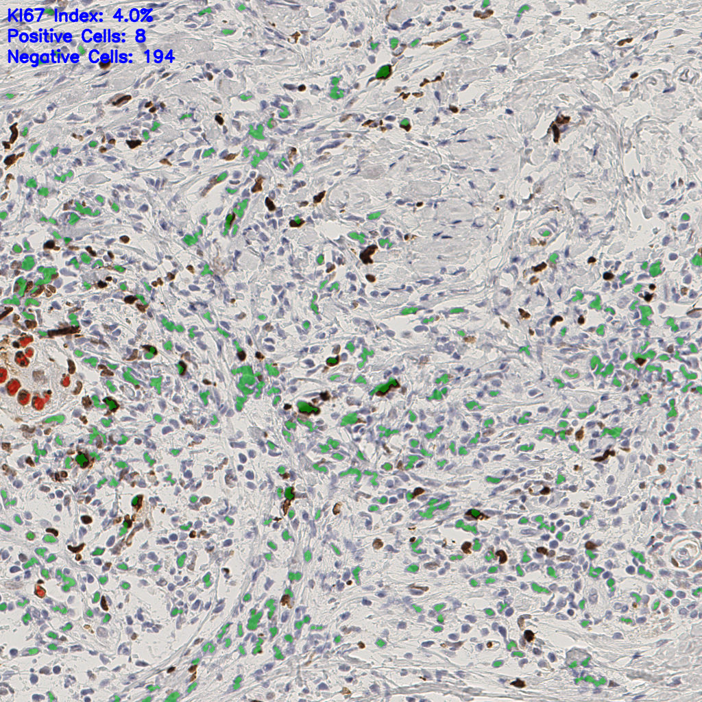 slice_43_18_x38528_y16128.png