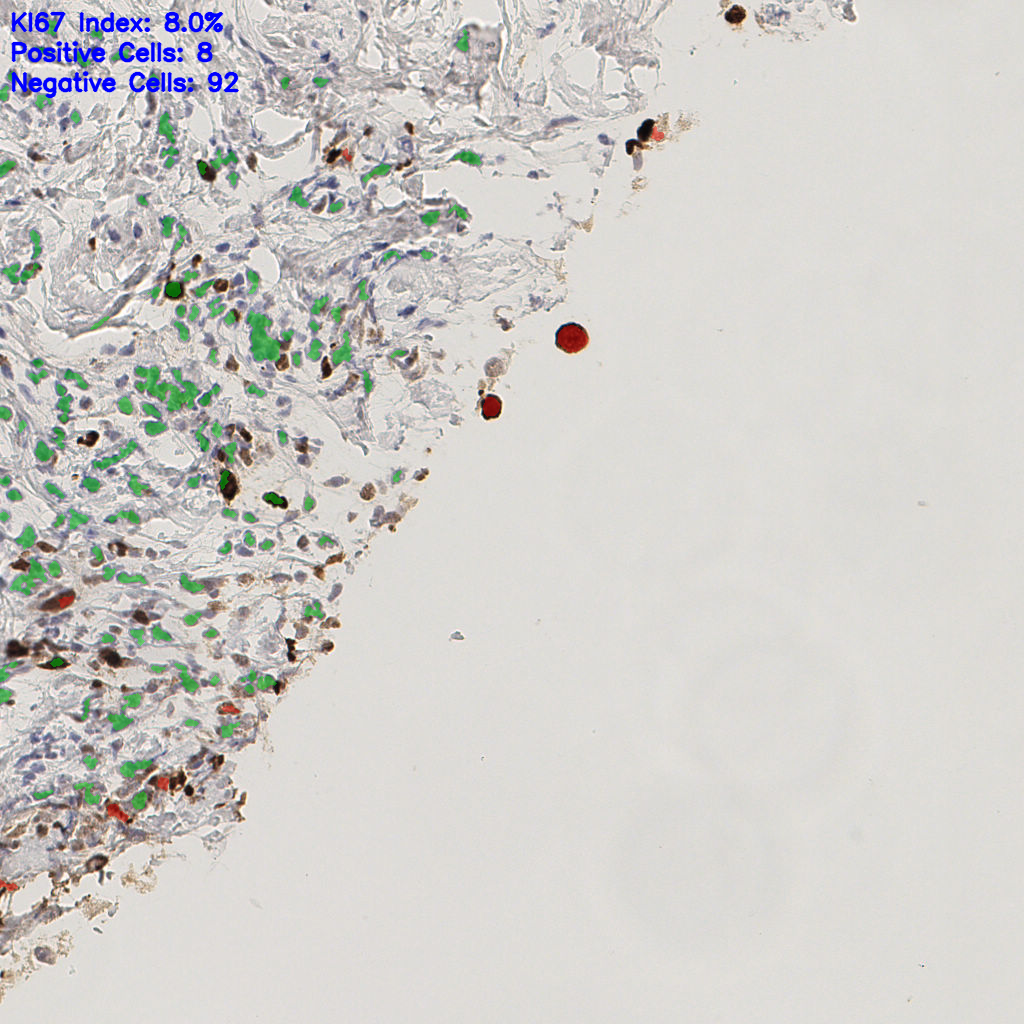 slice_43_8_x38528_y7168.png