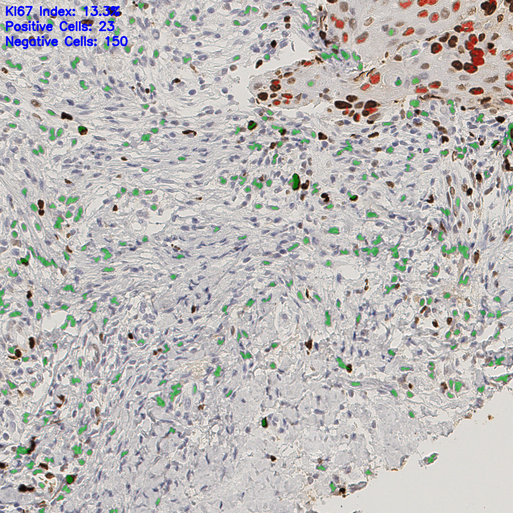 slice_44_15_x39424_y13440.png