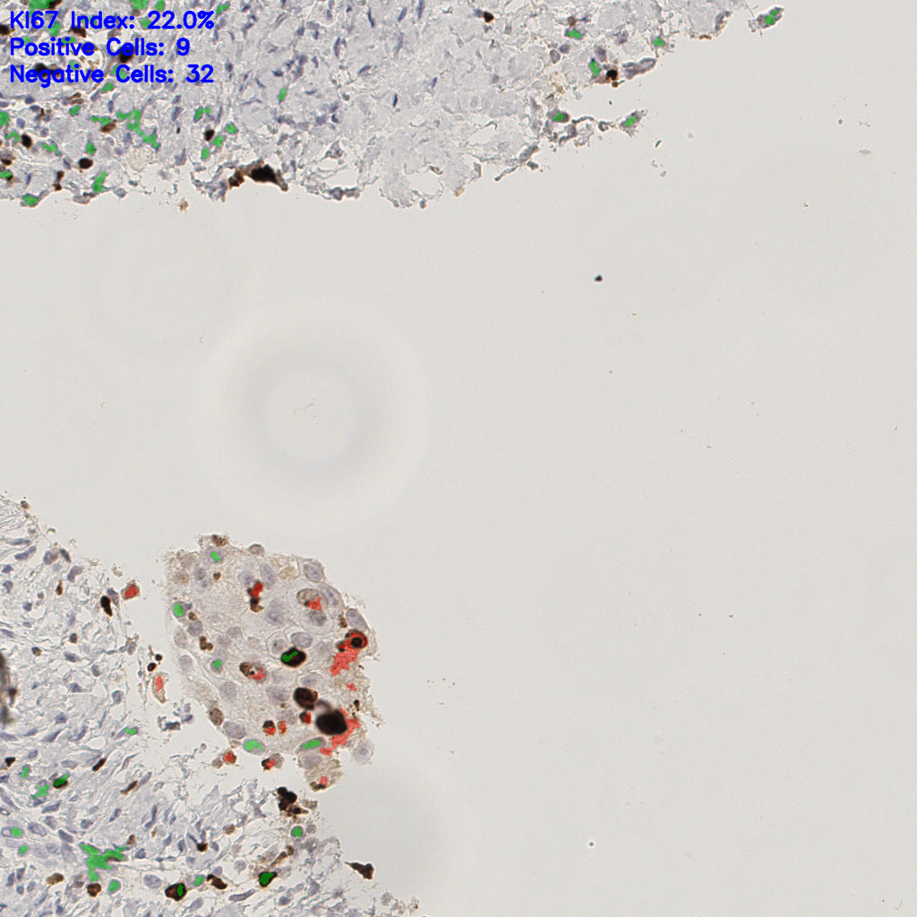 slice_44_16_x39424_y14336.png