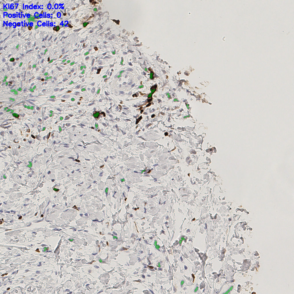 slice_44_17_x39424_y15232.png