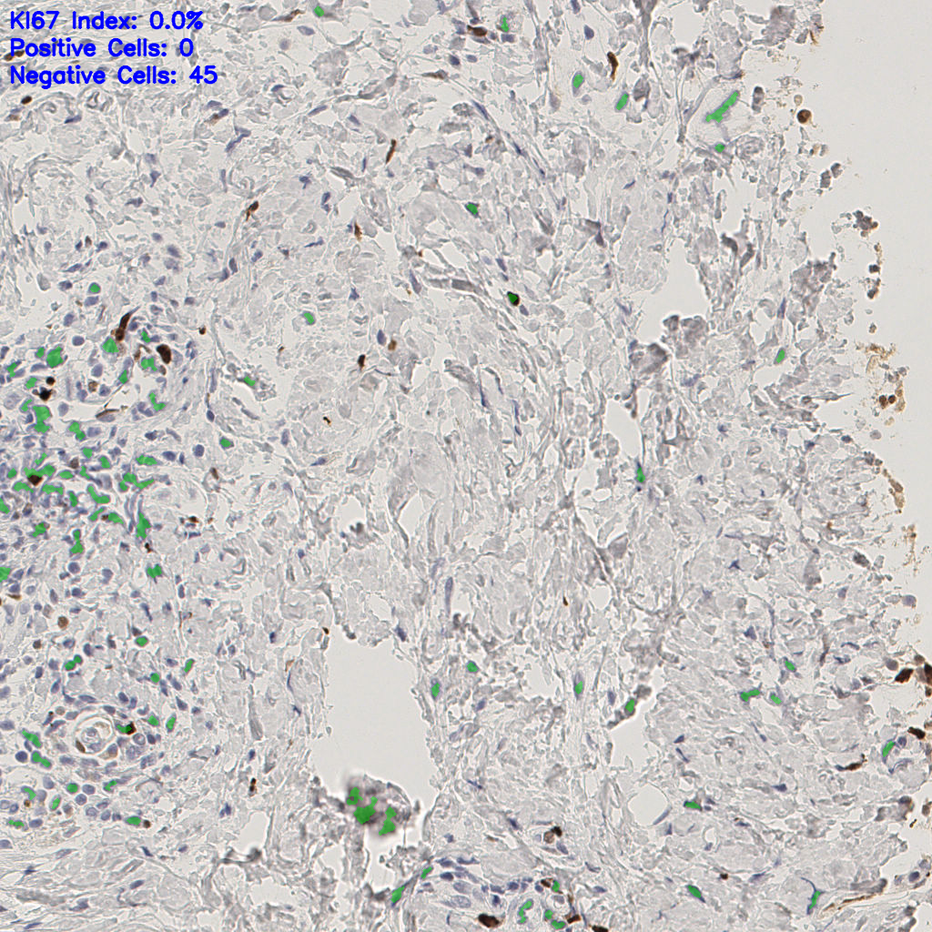 slice_44_18_x39424_y16128.png