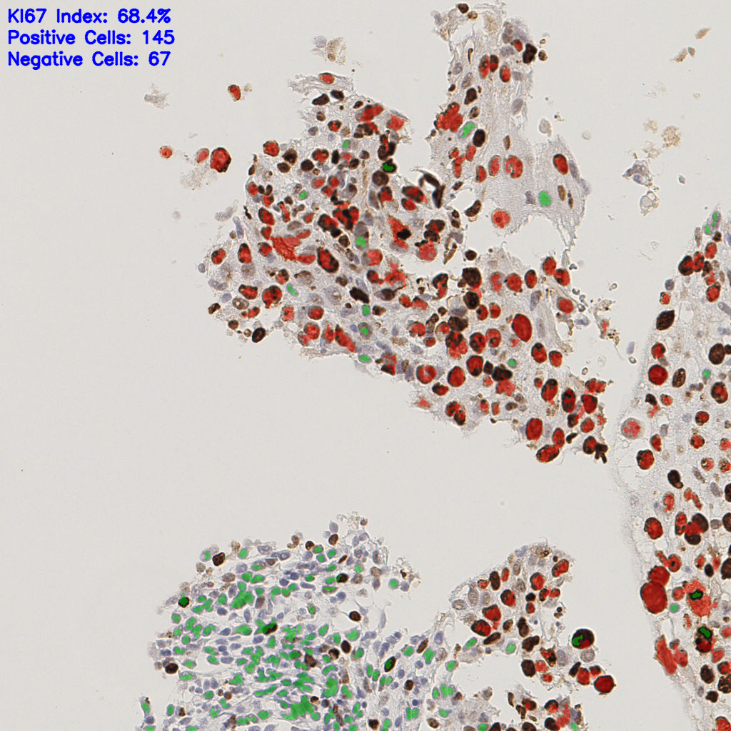slice_45_13_x40320_y11648.png