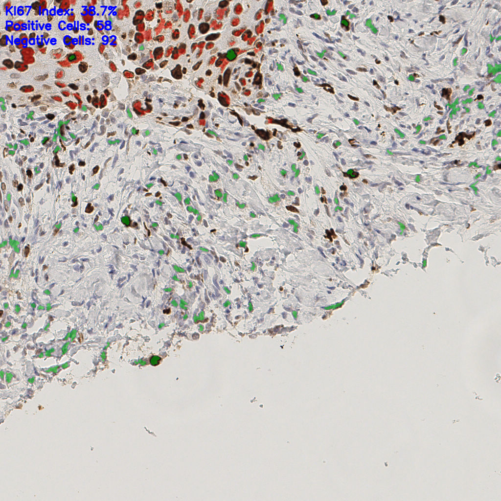 slice_45_15_x40320_y13440.png