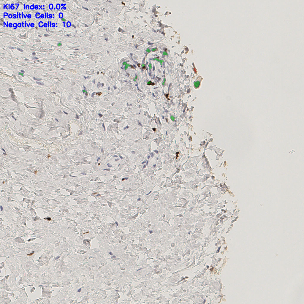 slice_45_20_x40320_y17920.png