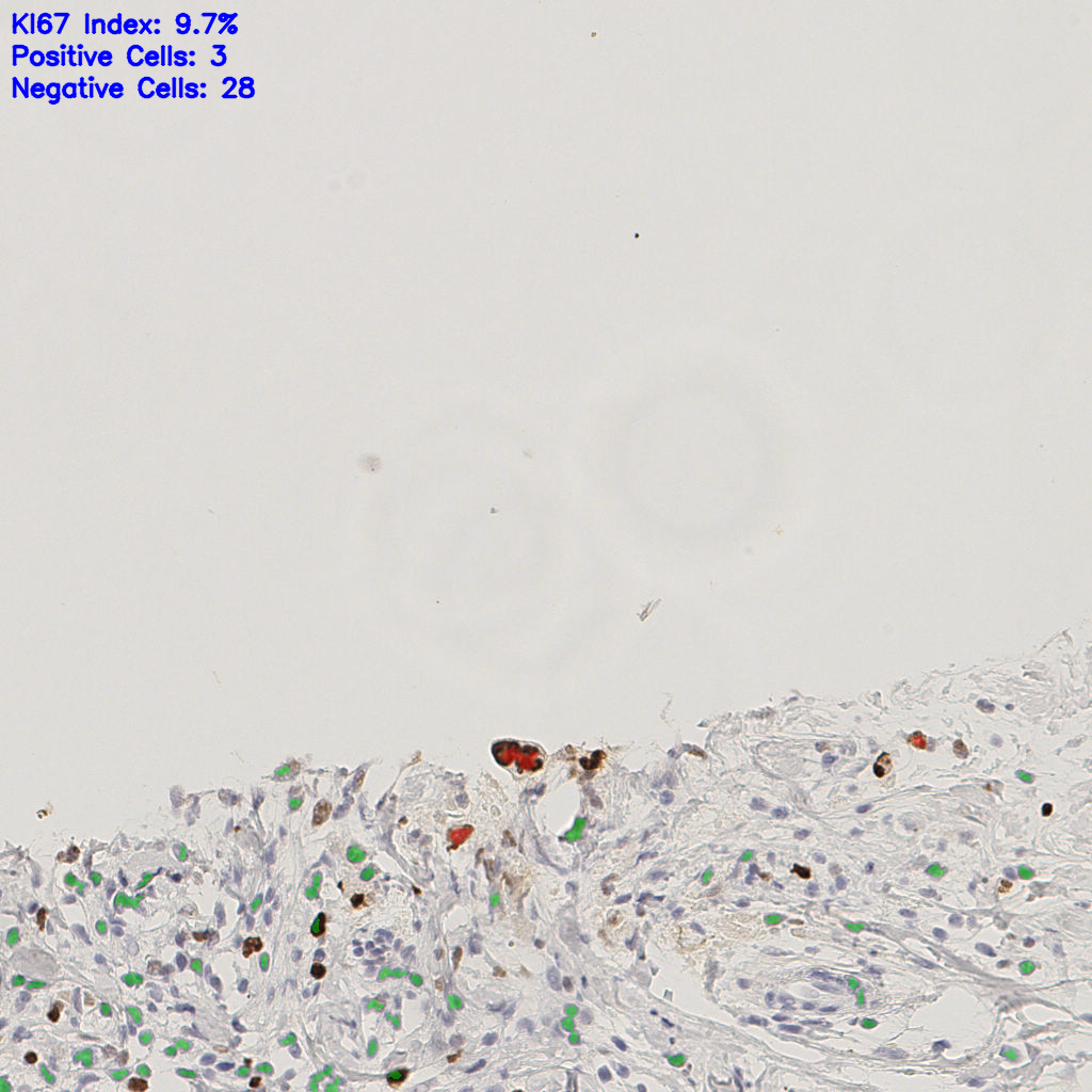 slice_47_12_x42112_y10752.png