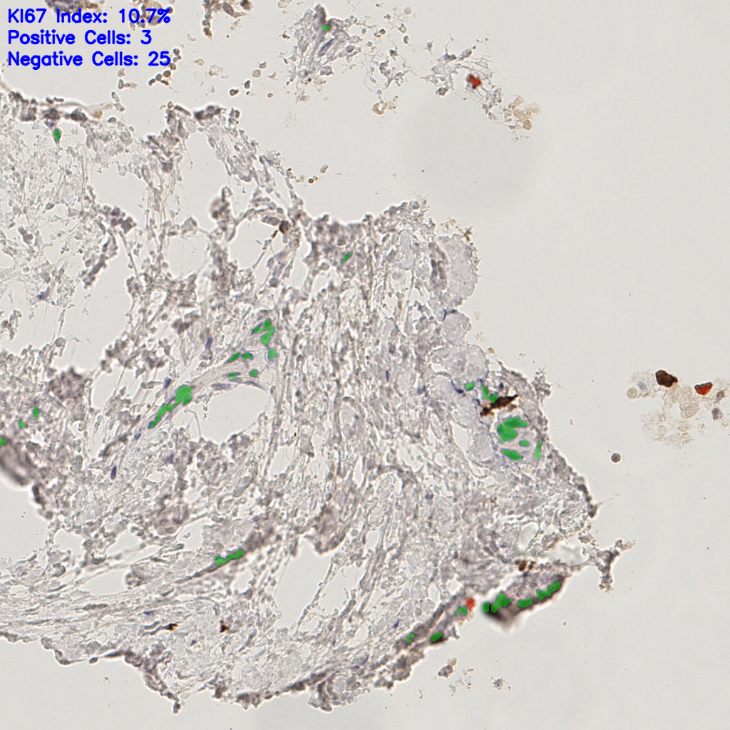 slice_47_23_x42112_y20608.png
