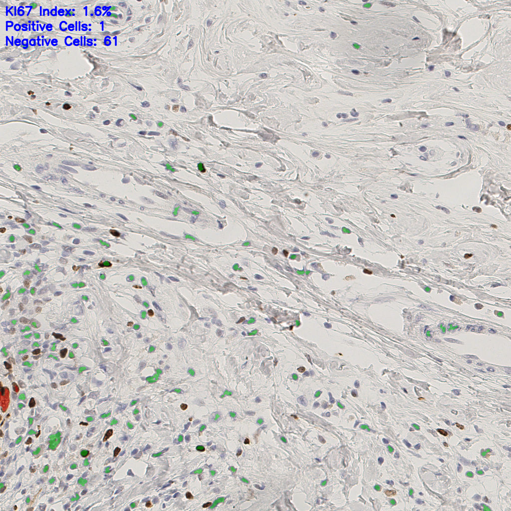 slice_48_13_x43008_y11648.png