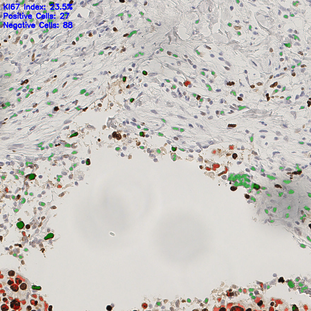 slice_48_14_x43008_y12544.png