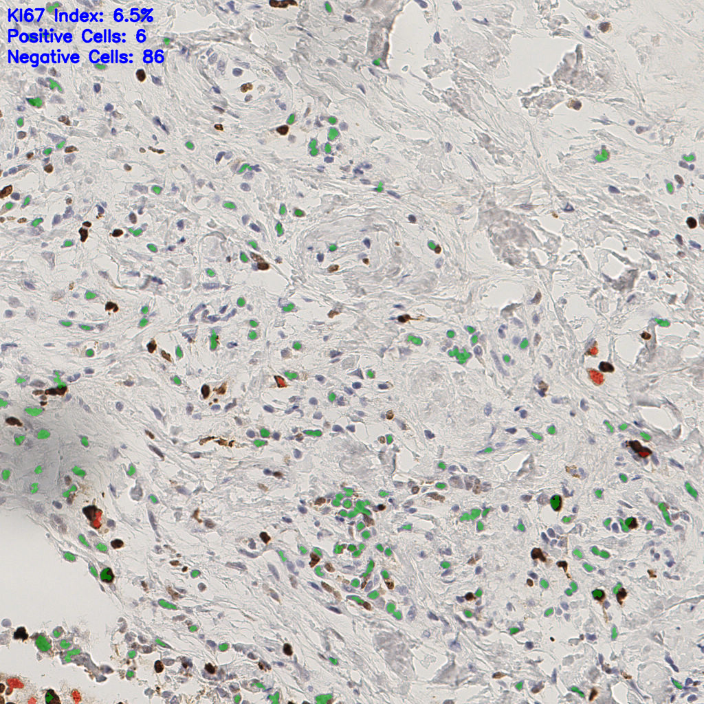slice_49_14_x43904_y12544.png