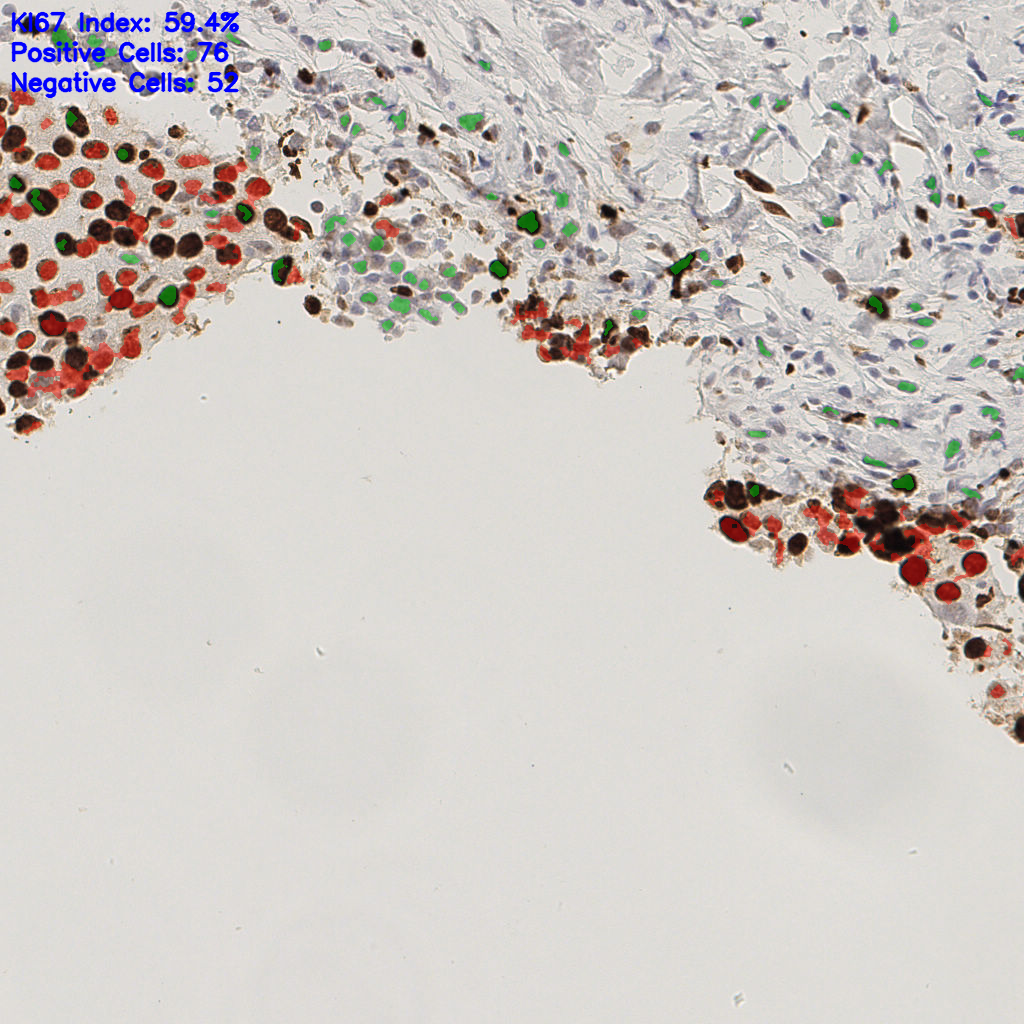 slice_49_15_x43904_y13440.png