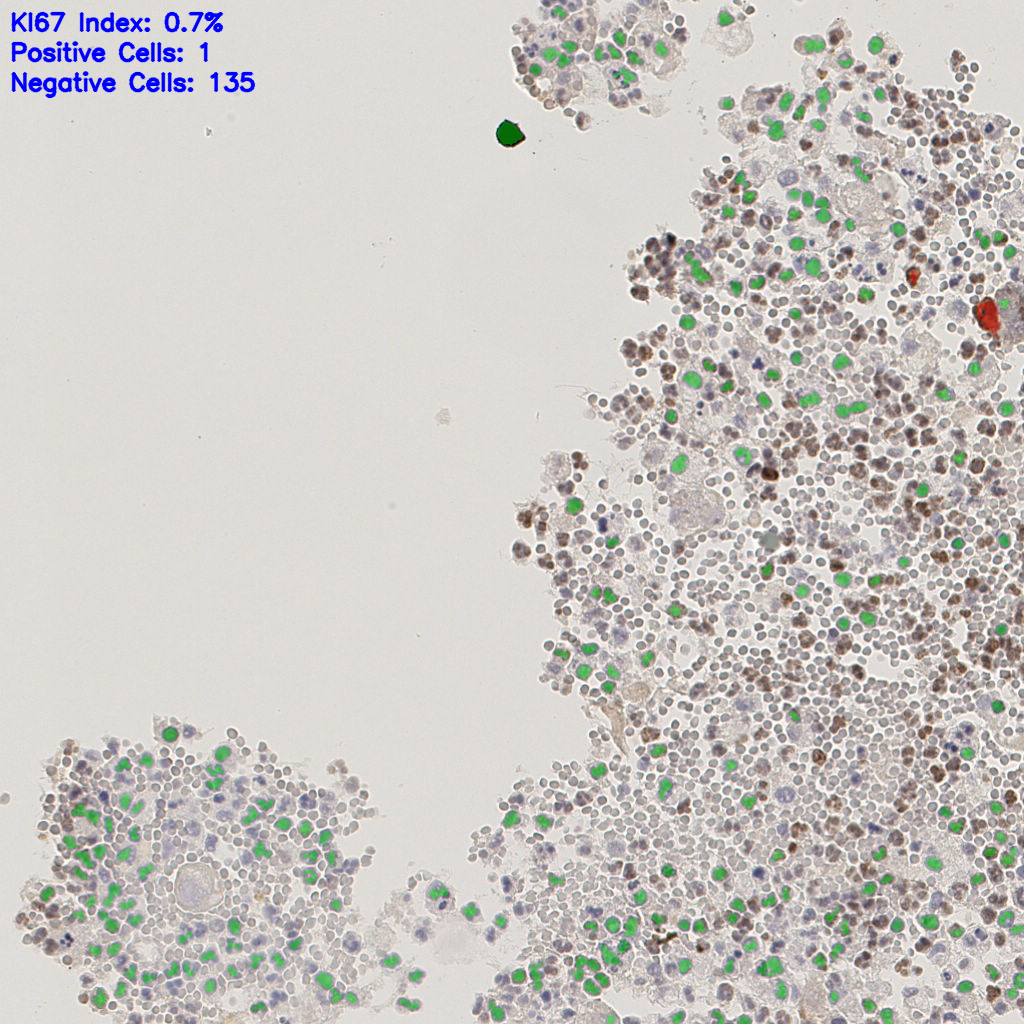 slice_4_14_x3584_y12544.png