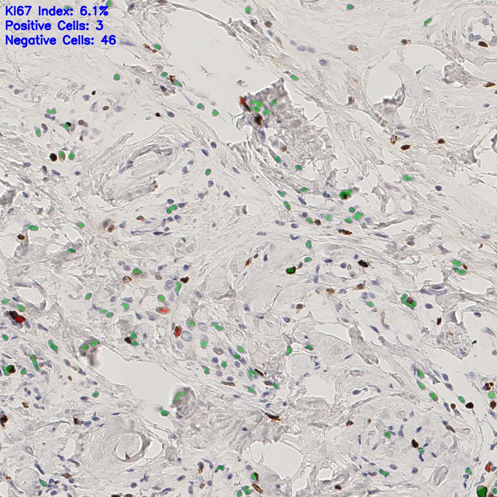 slice_50_14_x44800_y12544.png