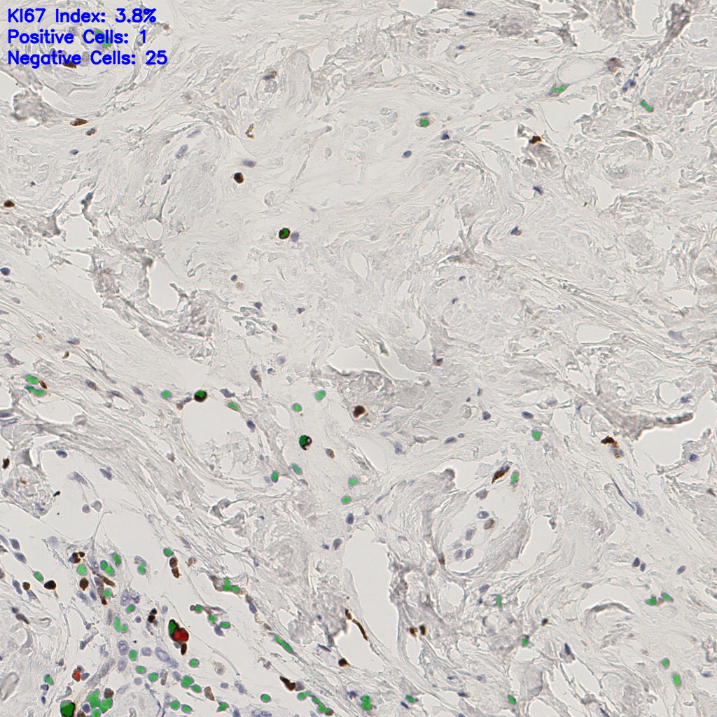slice_51_14_x45696_y12544.png