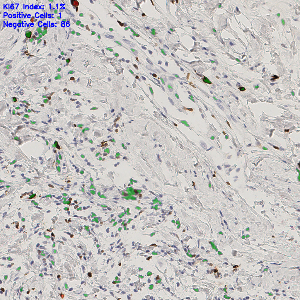 slice_51_15_x45696_y13440.png