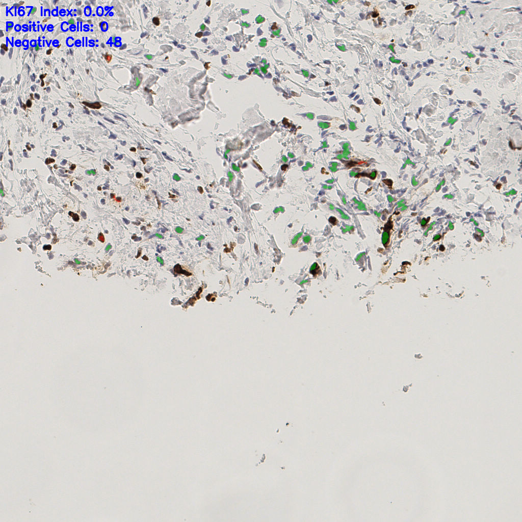 slice_51_16_x45696_y14336.png