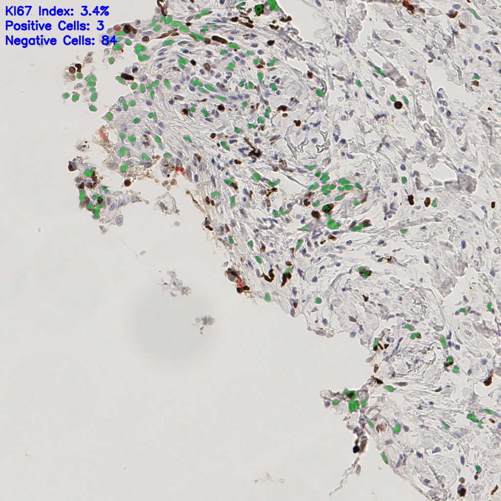 slice_51_5_x45696_y4480.png