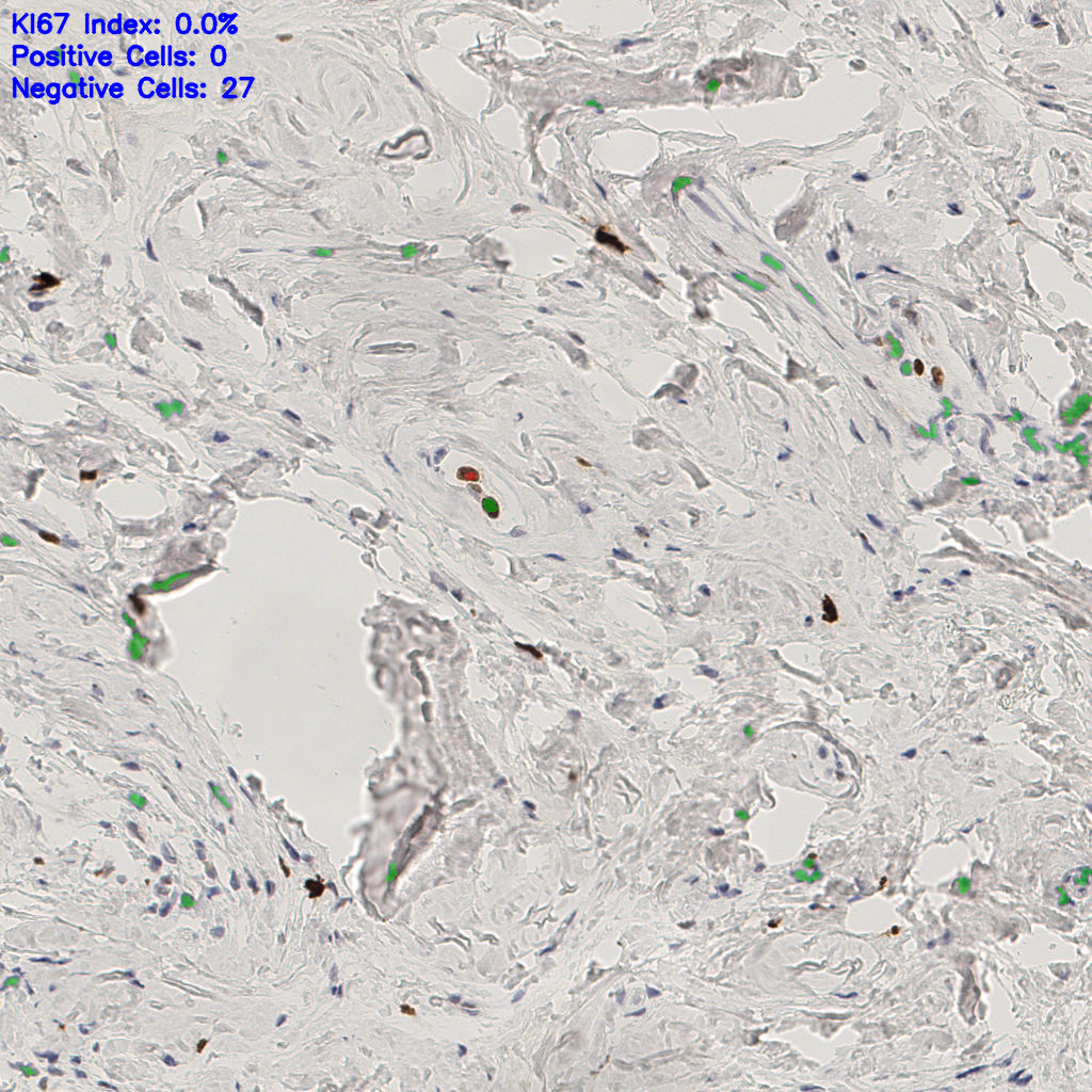 slice_52_15_x46592_y13440.png