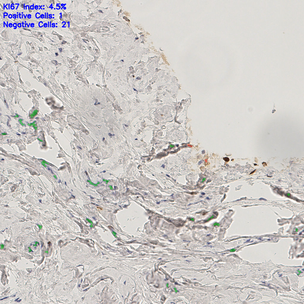 slice_53_15_x47488_y13440.png