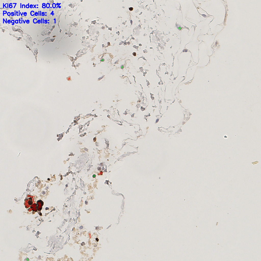 slice_55_13_x49280_y11648.png