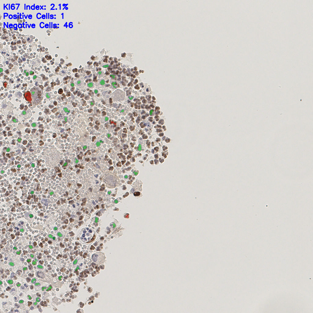 slice_5_14_x4480_y12544.png