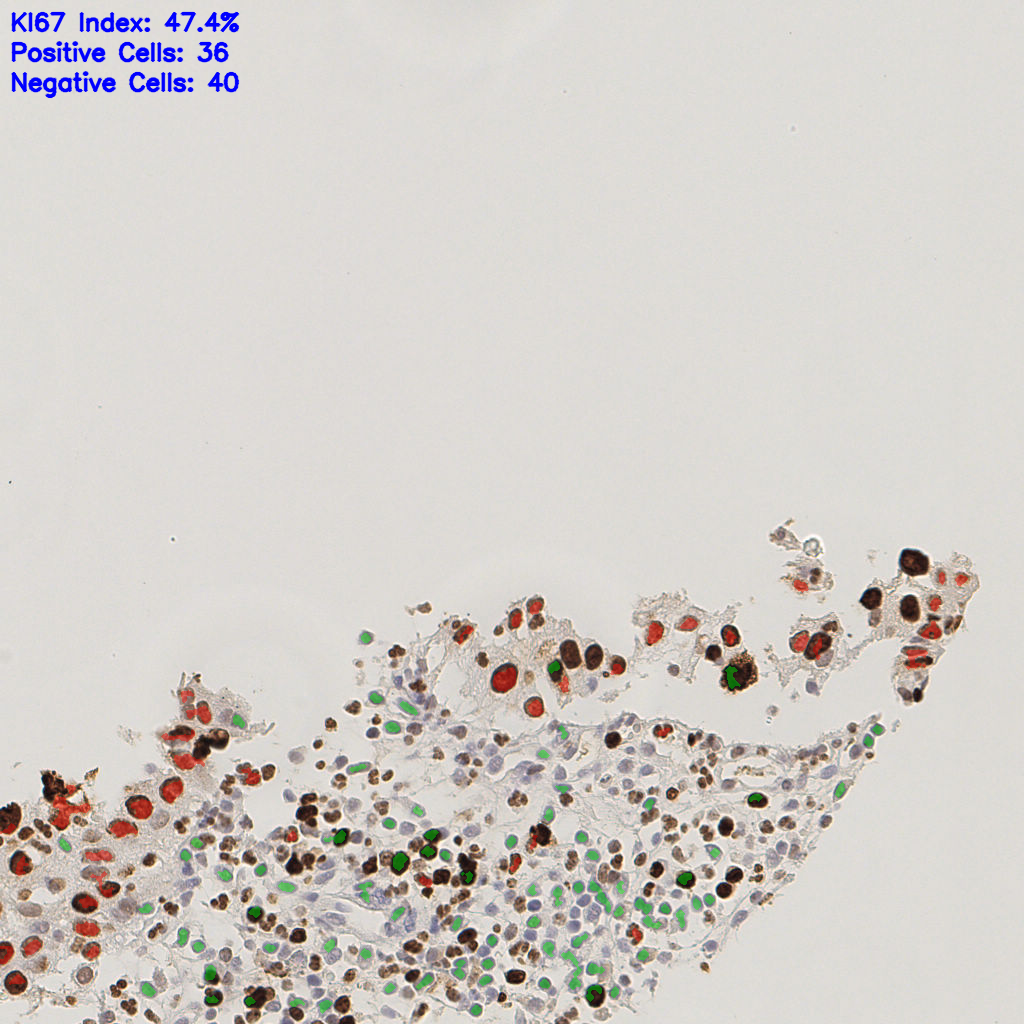 slice_5_26_x4480_y23296.png