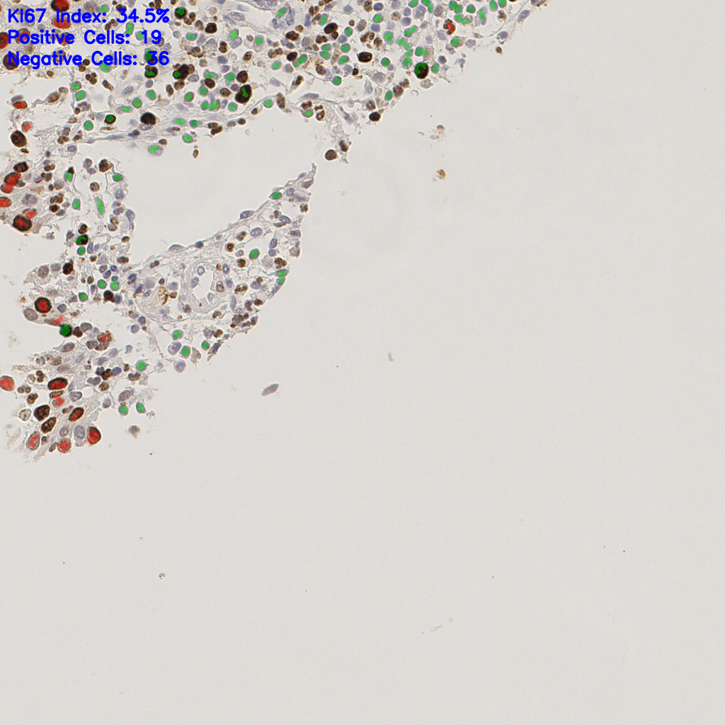 slice_5_27_x4480_y24192.png