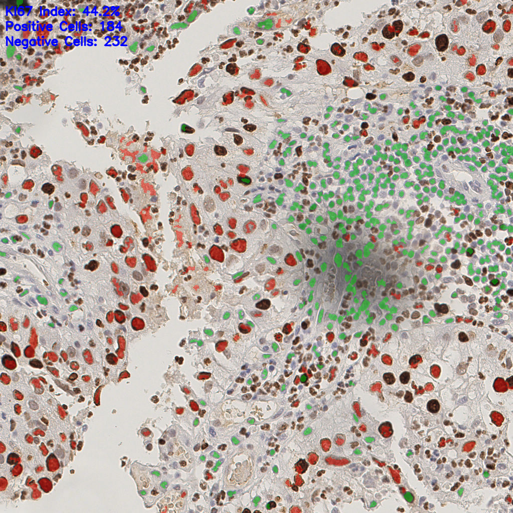 slice_8_21_x7168_y18816.png