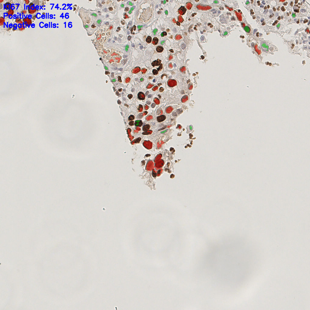 slice_8_22_x7168_y19712.png