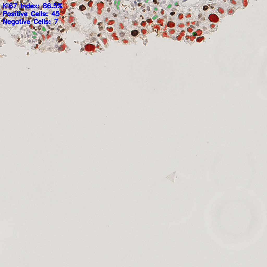 slice_9_22_x8064_y19712.png