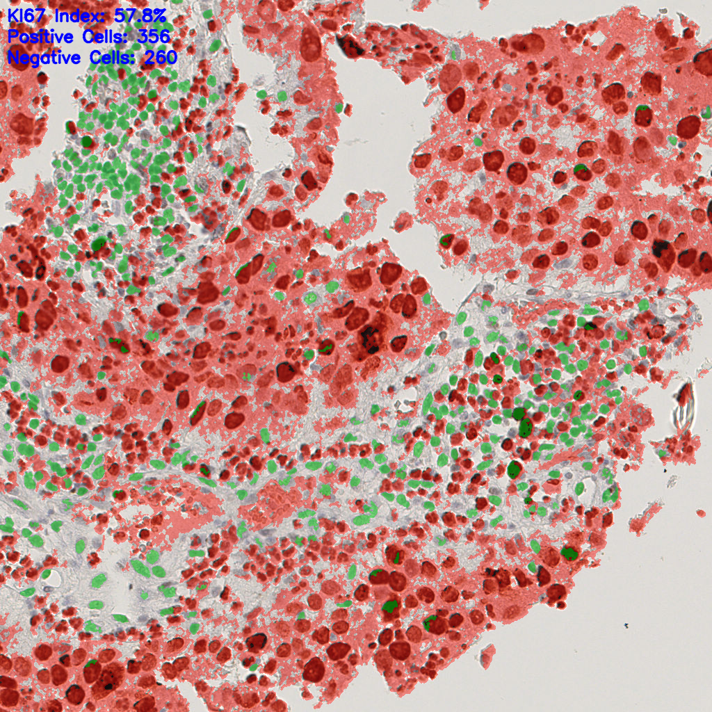 slice_10_20_x8960_y17920.png