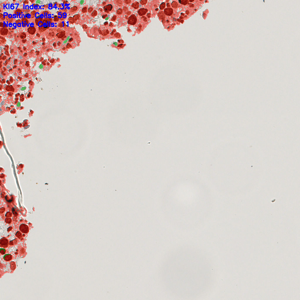 slice_10_21_x8960_y18816.png