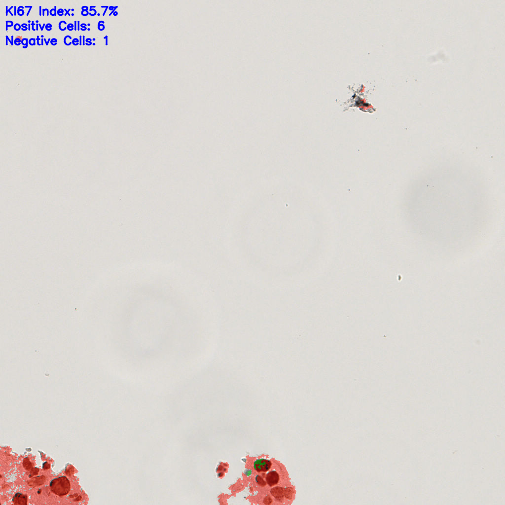 slice_11_19_x9856_y17024.png