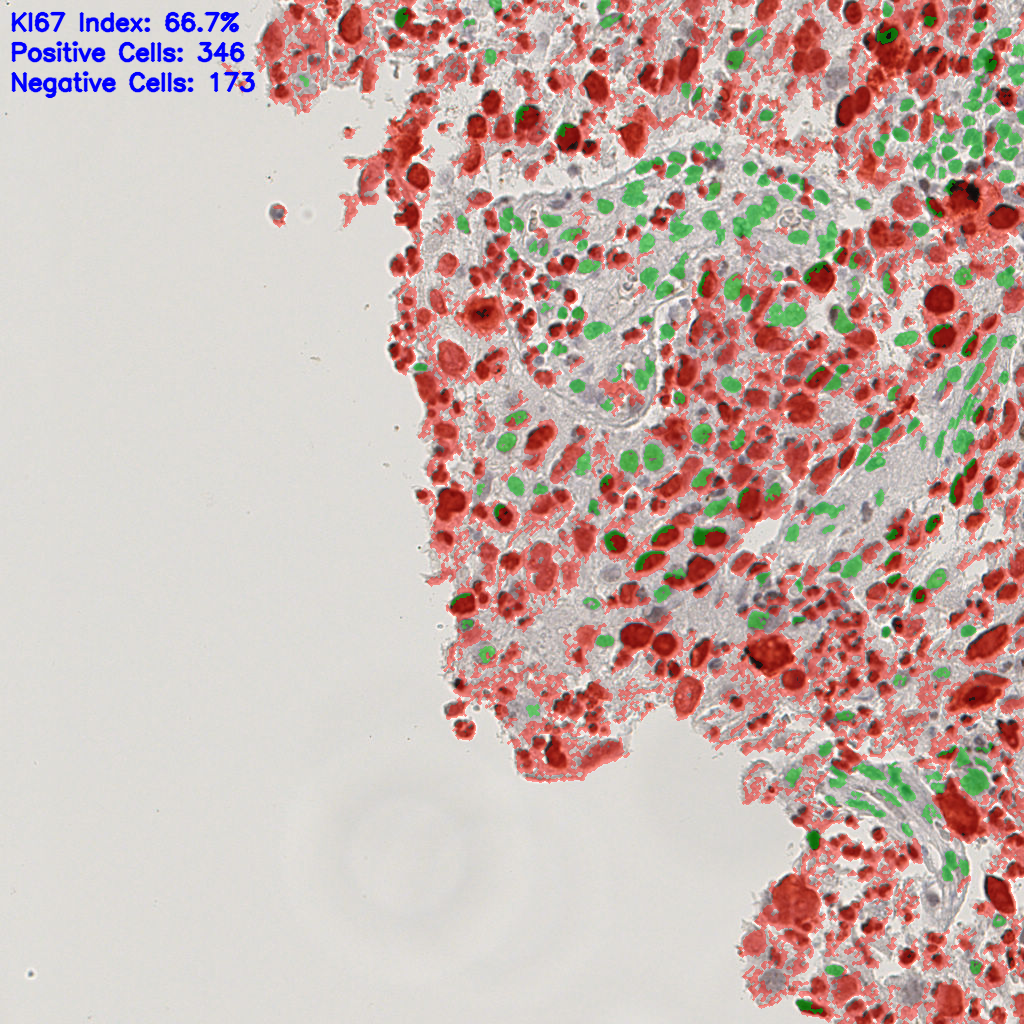 slice_14_12_x12544_y10752.png
